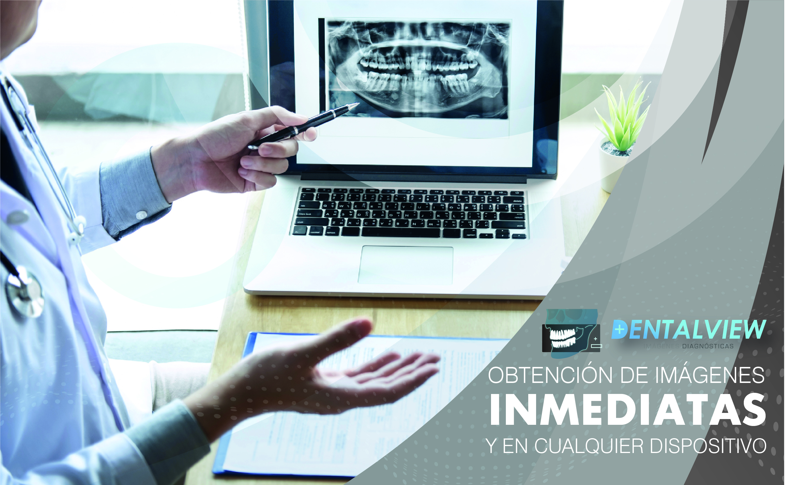 Post para dental view 2